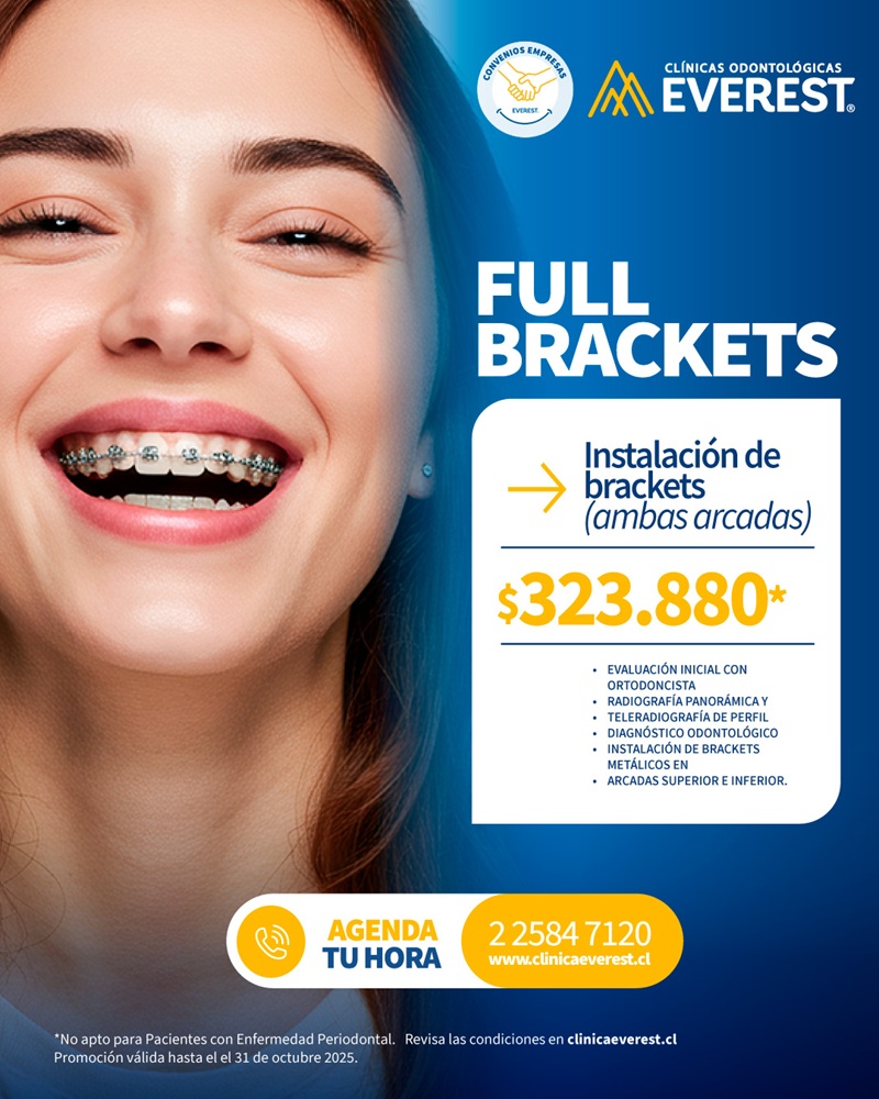 brackets_post_convenio_arreglada brackets_post_convenio_arreglada
